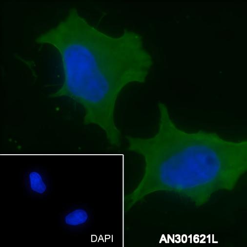 Recombinant PCK2 Monoclonal Antibody - small - 2