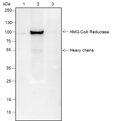 Recombinant HMGCR Monoclonal Antibody - small - 4