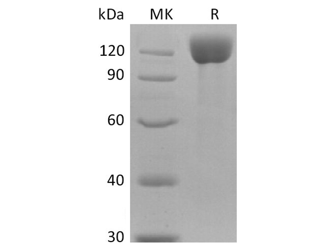 Recombinant Human APN Protein (His Tag)
