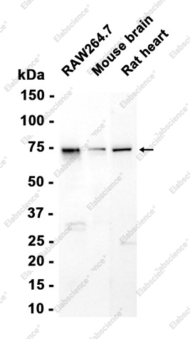 Recombinant ARHGAP25 Monoclonal Antibody - 1