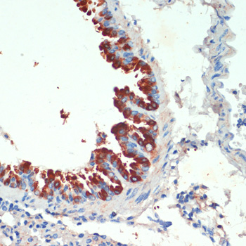 Immunohistochemistry of paraffin-embedded Mouse lung using KIF5B Polyclonal Antibody at dilution of  1:200 (40x lens).