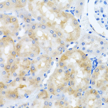 Immunohistochemistry of paraffin-embedded Rat kidney using SCO1 Polyclonal Antibody at dilution of 1:100 (40x lens).