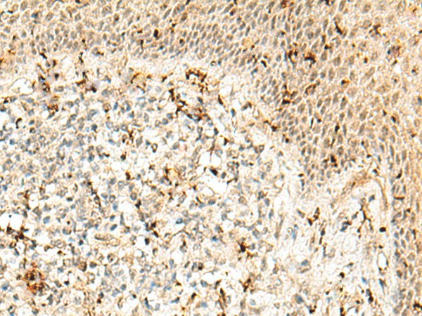 Immunohistochemistry of paraffin-embedded Human tonsil tissue  using RBM15 Polyclonal Antibody at dilution of 1:50(?200)