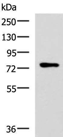 Western blot analysis of Mouse thymus tissue lysate  using L3MBTL2 Polyclonal Antibody at dilution of 1:800