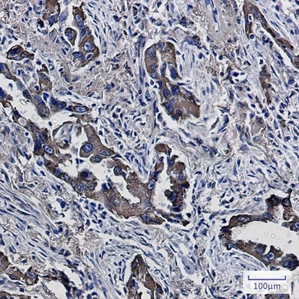 Recombinant PON2 Monoclonal Antibody - 2