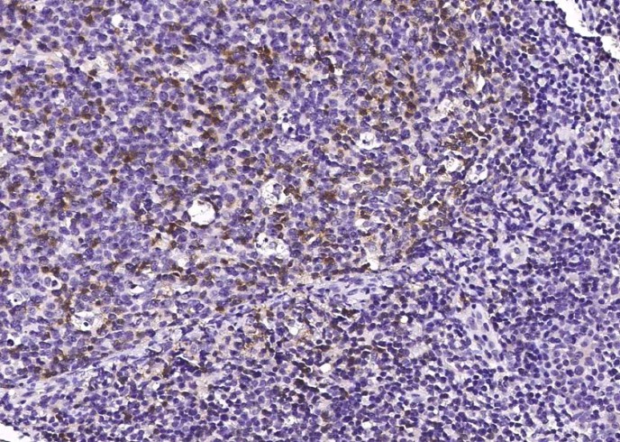 Recombinant PD1/PDCD1/CD279 Monoclonal Antibody-searchlist-1