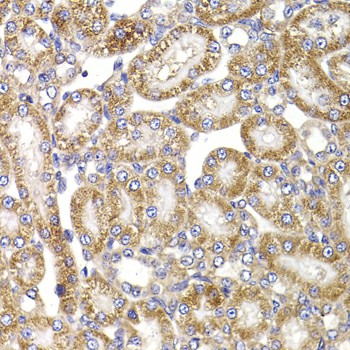 Immunohistochemistry of paraffin-embedded Rat kidney using ANAPC5 Polyclonal Antibody at dilution of 1:100 (40x lens).