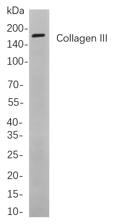 Recombinant Collagen III Monoclonal Antibody-searchlist-1