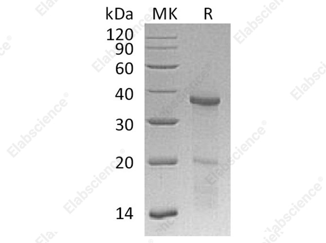 Recombinant Human HOXB4 Protein (His Tag) - 1