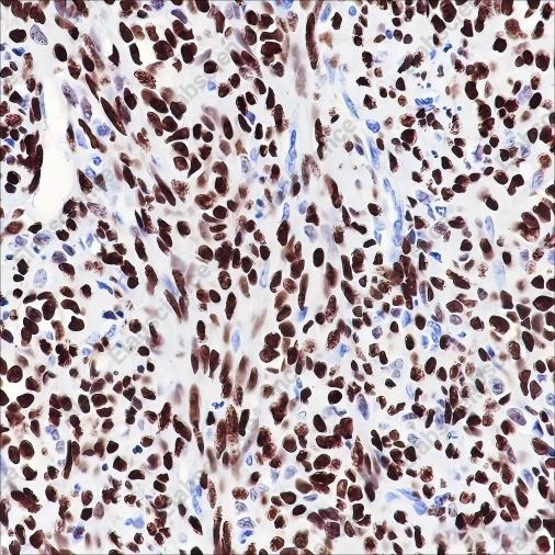 Recombinant FOXL2 Monoclonal Antibody - 2