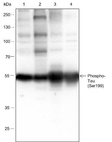 Recombinant Phospho-Tau (Ser199) Monoclonal Antibody-searchlist-1