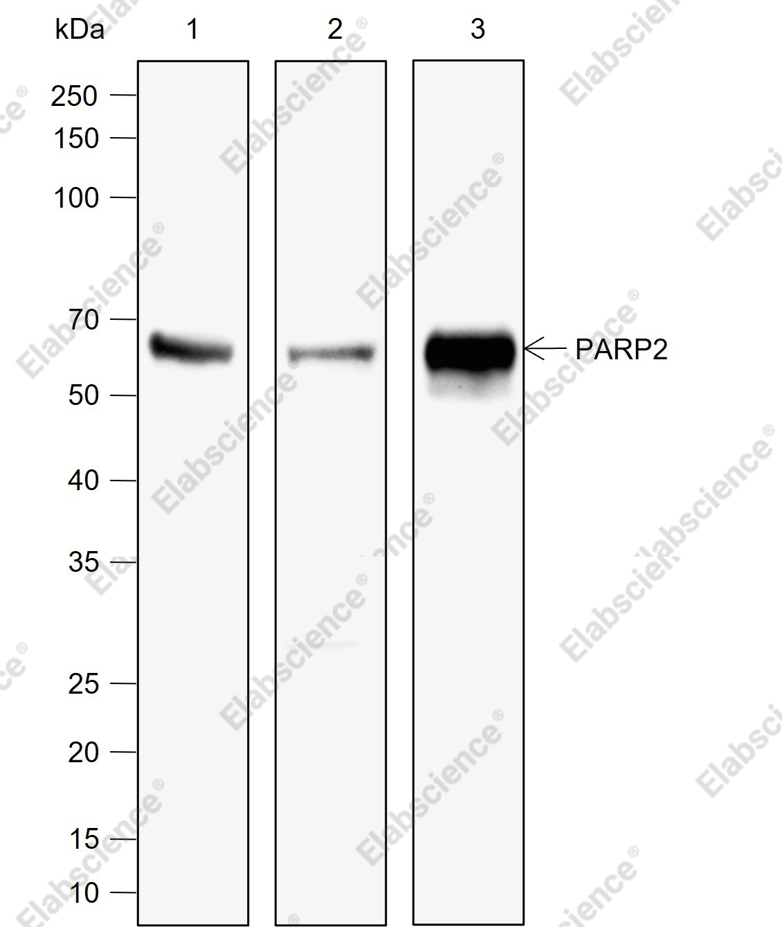 Recombinant PARP2 Monoclonal Antibody - 1