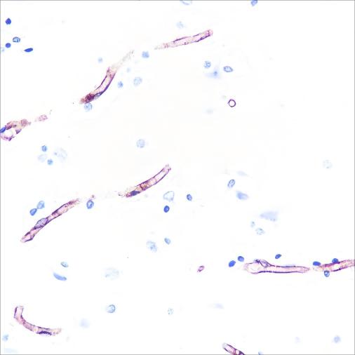 Recombinant Claudin-5 Monoclonal Antibody - 2