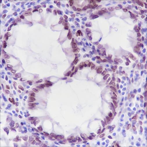 Recombinant FBXW7 Monoclonal Antibody - 2