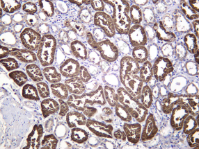 Recombinant VEGF-D Monoclonal Antibody - 2
