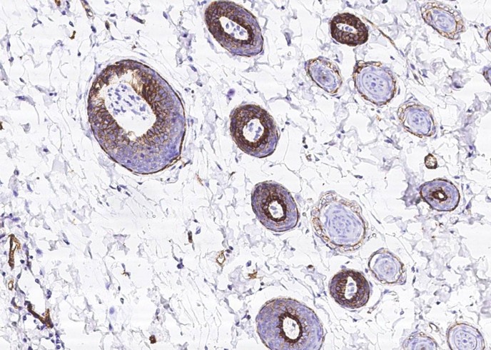 Recombinant BCAM/CD239 Monoclonal Antibody-searchlist-1