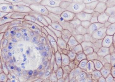 Recombinant Claudin-1 Monoclonal Antibody-searchlist-2