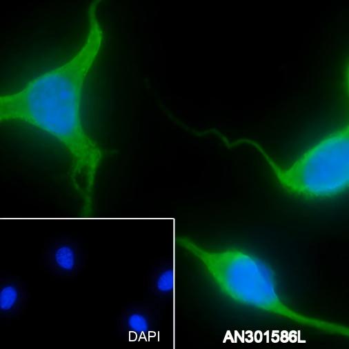 Recombinant Laminin Receptor Monoclonal Antibody - 2