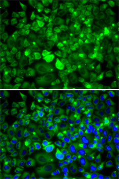 Immunofluorescence analysis of MCF7 cells using RPLP1 Polyclonal Antibody Blue: DAPI for nuclear staining.