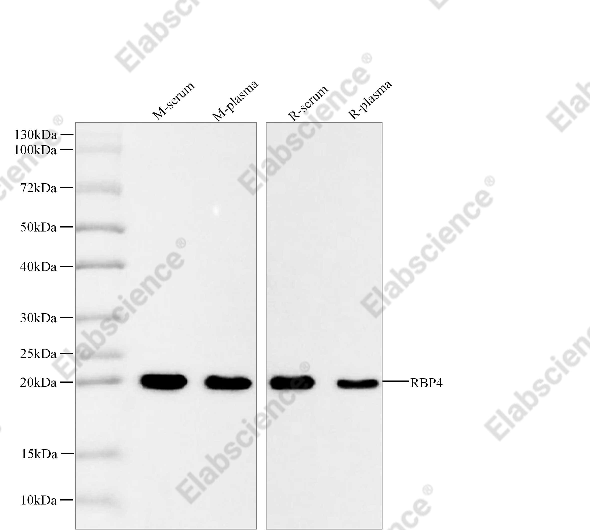 Recombinant RBP4 Monoclonal Antibody - 1