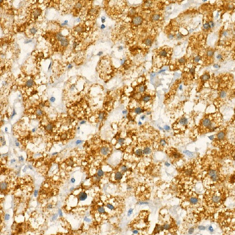 Immunohistochemistry of paraffin-embedded human liver using COX1 Polyclonal Antibody at dilution of 1:25 (40x lens).Perform high pressure antigen retrieval with 10 mM citrate buffer pH 6.0 before commencing with IHC staining protocol.