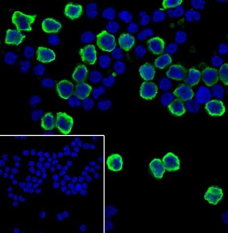 Recombinant S100A9 Monoclonal Antibody - small - 4