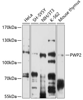 Western blot analysis of extracts of various cell lines using PWP2 Polyclonal Antibody at 1:1000 dilution.