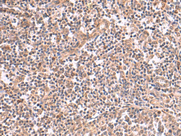 Immunohistochemistry of paraffin-embedded Human tonsil tissue  using SLC12A7 Polyclonal Antibody at dilution of 1:50(?200)