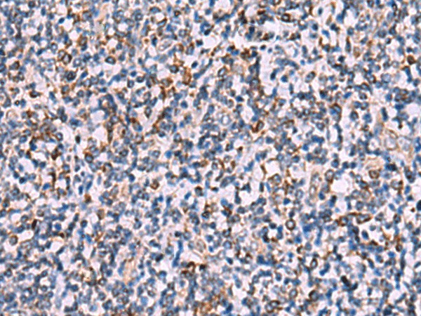 Immunohistochemistry of paraffin-embedded Human tonsil tissue  using IPPK Polyclonal Antibody at dilution of 1:30(?200)