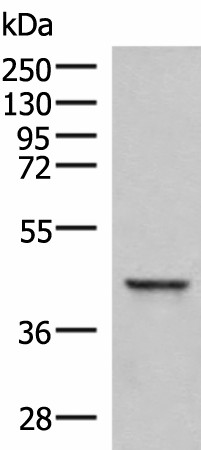 Western blot analysis of Hela cell lysate  using SAMSN1 Polyclonal Antibody at dilution of 1:800