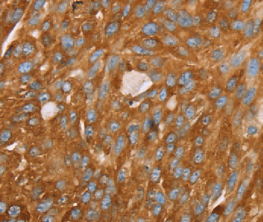 PAICS Polyclonal Antibody - 3