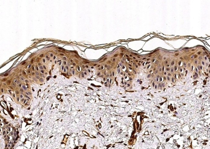 Recombinant Caspase-14/CASP14 Monoclonal Antibody - small - 2