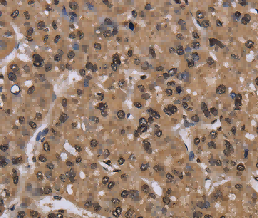 CSNK2A1 Polyclonal Antibody - 2