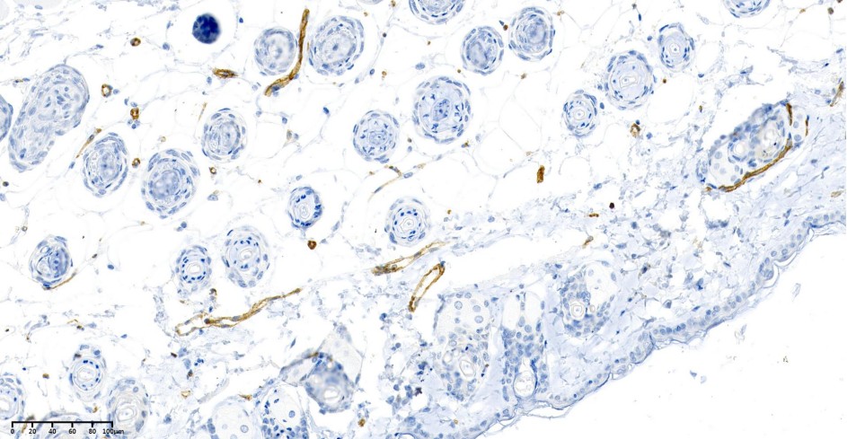Recombinant CD31 Monoclonal Antibody - small - 2