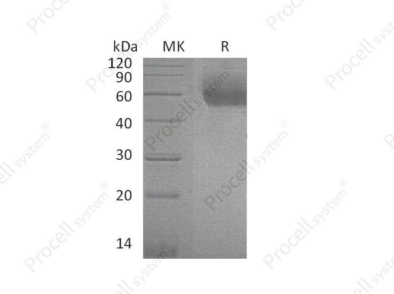 IL-1RL1/IL-1 R4 (C-6His), Mouse, Recombinant