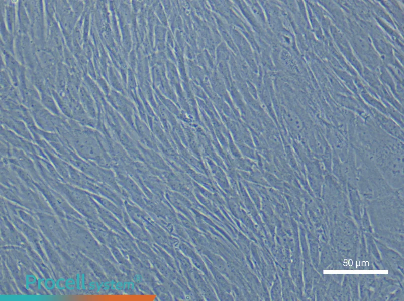 Human Cerebral Artery Smooth Muscle Cell Complete Medium - 4