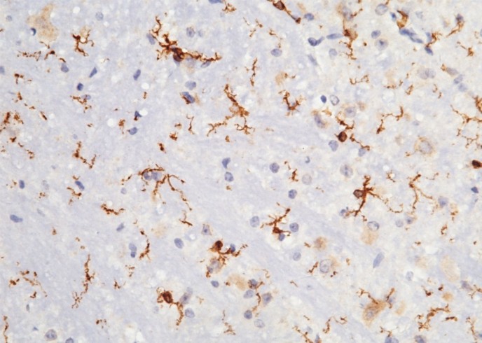 Recombinant CD64/FCGR1 Monoclonal Antibody - small - 3