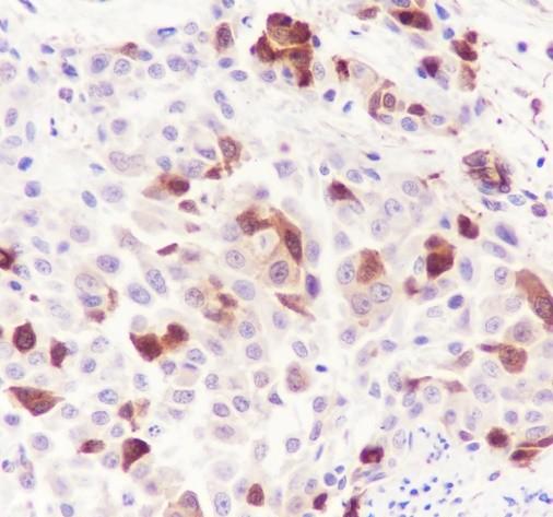 Recombinant Phospho-HSP27 (Ser78) Monoclonal Antibody - 3