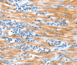 ALDOB Polyclonal Antibody - 3