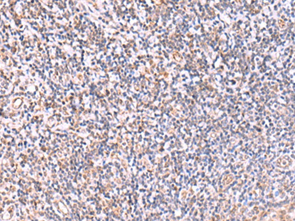 Immunohistochemistry of paraffin-embedded Human tonsil tissue  using ITPKC Polyclonal Antibody at dilution of 1:40(?200)