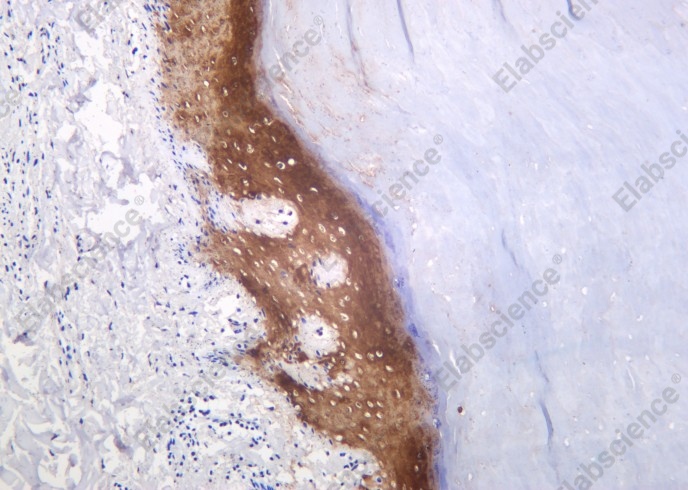 Recombinant Cytokeratin 10 Monoclonal Antibody - 2