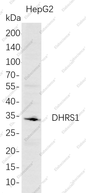 Recombinant DHRS1 Monoclonal Antibody - 1