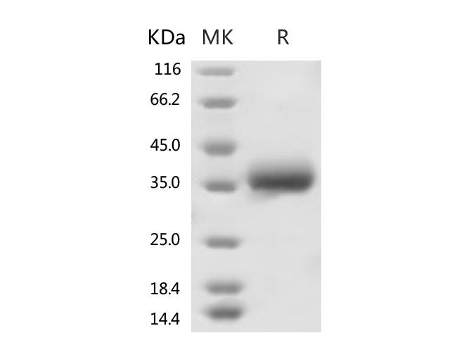 Immobilized Recombinant Human ACE2 Protein (mFc Tag)(Cat: PKSR030509) at 2 ug/mL (100 uL/well) can bind Recombinant 2019-nCoV Spike Protein (RBD, His Tag)(Cat: PKSR030519), the EC50 of Recombinant 2019-nCoV Spike Protein (RBD, His Tag)(Cat: PKSR030519) is 40-80 ng/mL.