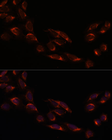 Immunofluorescence analysis of U2OS cells using NSDHL Polyclonal Antibody at dilution of 1:100. Blue: DAPI for nuclear staining.