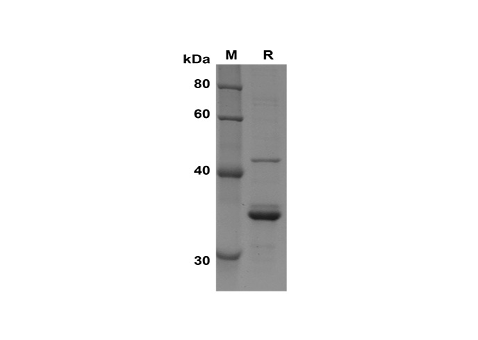 Recombinant Human CD40 Protein(His Tag)-产品推荐-1