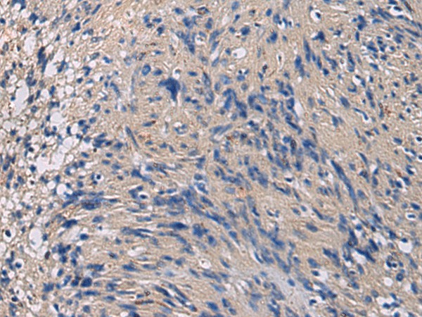 Immunohistochemistry of paraffin-embedded Human brain tissue  using CHST3 Polyclonal Antibody at dilution of 1:35(?200)