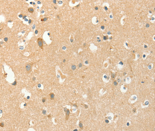 Immunohistochemistry of paraffin-embedded Human brain tissue using AANAT Polyclonal Antibody at dilution 1:40