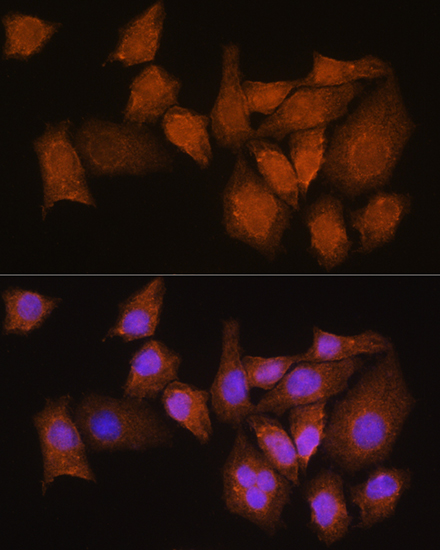 Immunofluorescence analysis of HeLa cells using NMNAT3 Polyclonal Antibody at dilution of 1:100. Blue: DAPI for nuclear staining.