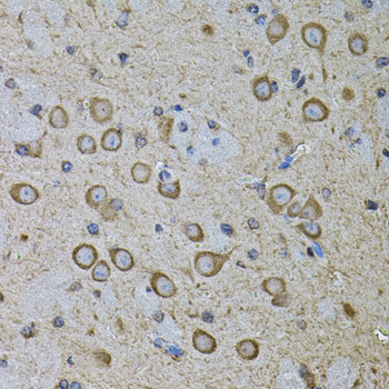 Immunohistochemistry of paraffin-embedded Mouse brain using CDH16 Polyclonal Antibody at dilution of 1:100 (40x lens).