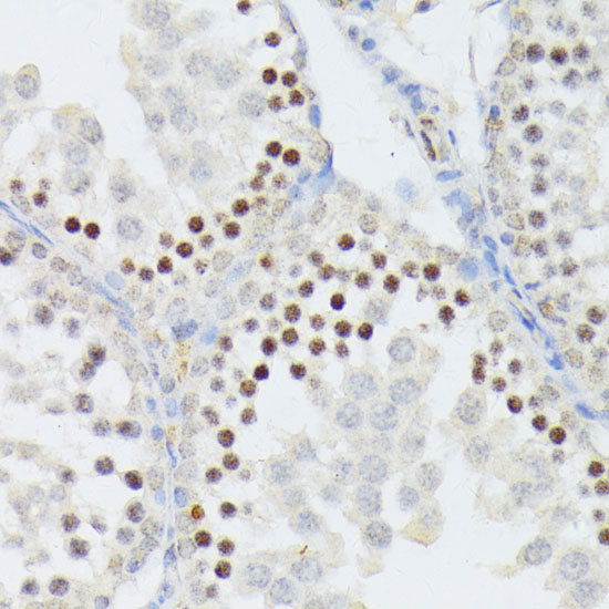 Immunohistochemistry of paraffin-embedded Mouse testis using ANKRD52 Polyclonal Antibody at dilution of 1:100 (40x lens).